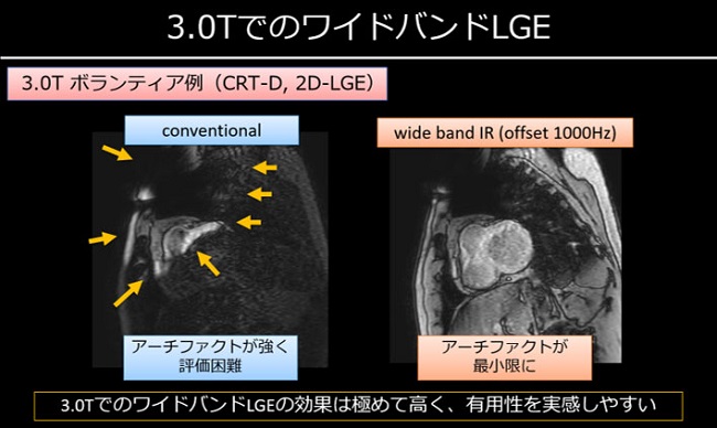 講演資料1
