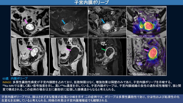 講演資料2