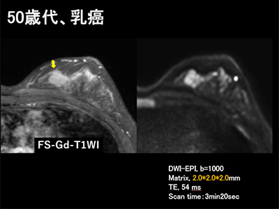 講演資料1
