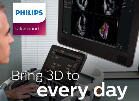 Reproducible EF in seconds - Philips EPIQ 7 HeartModelᴬ⋅ᴵ⋅(再現性のあるEFを数秒で提供:フィリップス EPIQ 7 HeartModelᴬ⋅ᴵ⋅)