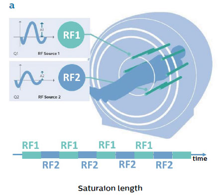 図2.MultiTransmit 4Dの応用 Saturaion length