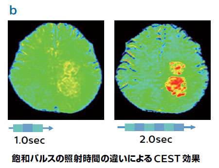 図2.MultiTransmit 4Dの応用 飽和パルスの照射時間の違いによるCEST効果