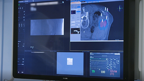 Philips Azurion 7 C20のお客様の声、St. Antonius Nieuwegein(オランダ)