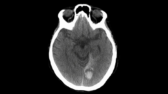 CBCT(CTライク) image