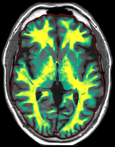 Smart Quant Neuro