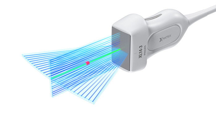 縦断面および横断面の同時リアルタイム画像 image