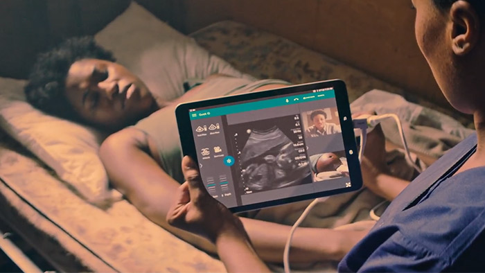 Philips Lumify